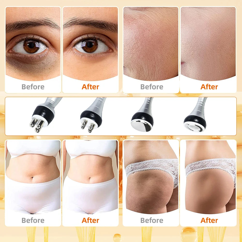 Moonic Beauty 4 In 1 Cavitation Body Slimming Vacuum Machine